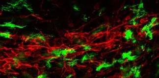 Immunfluoreszenzbild vom Gehirn junger Mäuse mit Crebraler Malaria: Mit den aktivierten Immunzellen des Gehirns (Mikrogliazellen, grün) breitet sich die Entzündung entlang eines röhrenförmigen Areals, des rostralen Migrationsstrangs (rot), bis in tiefere Hirnstrukturen aus. Dieser „Korridor“ für unreife Nerven- sowie Immunzellen im sich entwickelnden Gehirn junger Säugetiere ist offensichtlich besonders durchlässig und begünstigt die überschießende Entzündungsreaktion. (Foto: Universitätsklinikum Heidelberg)