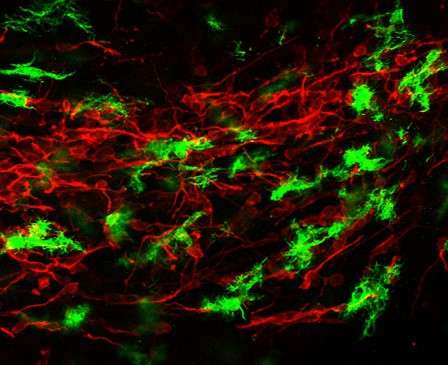 Immunfluoreszenzbild vom Gehirn junger Mäuse mit Crebraler Malaria: Mit den aktivierten Immunzellen des Gehirns (Mikrogliazellen, grün) breitet sich die Entzündung entlang eines röhrenförmigen Areals, des rostralen Migrationsstrangs (rot), bis in tiefere Hirnstrukturen aus. Dieser „Korridor“ für unreife Nerven- sowie Immunzellen im sich entwickelnden Gehirn junger Säugetiere ist offensichtlich besonders durchlässig und begünstigt die überschießende Entzündungsreaktion. (Foto: Universitätsklinikum Heidelberg)