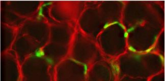 Zellen des Enterischen Nervensystems – rot eingefärbt sind die Zellen, wie sie bereits im Darm sind, grün eingefärbt sind die Zellen die im Forschungsprojekt über die Blutgefäße eingespritzt wurden (Foto: Hochschule Kaiserslautern)