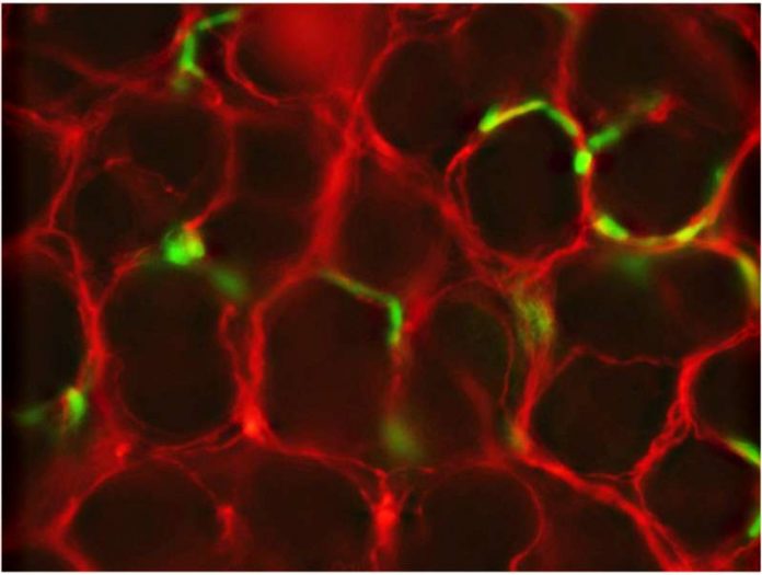 Zellen des Enterischen Nervensystems – rot eingefärbt sind die Zellen, wie sie bereits im Darm sind, grün eingefärbt sind die Zellen die im Forschungsprojekt über die Blutgefäße eingespritzt wurden (Foto: Hochschule Kaiserslautern)