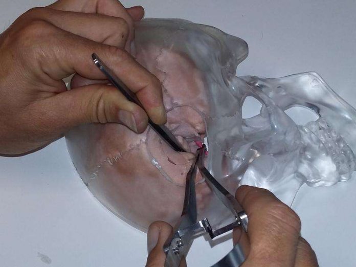 Mit einem solchen Modell trainieren Mediziner, Blutgefäße im Hirn mit einem Aneurysmen-Clip abzuklemmen. (Foto: Bendler/IVW)