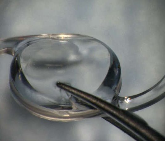 Einzigartige Linse zur Korrektur von 40 Dioptrien Zylinderwert (Foto: Universitätsmedizin Mainz)