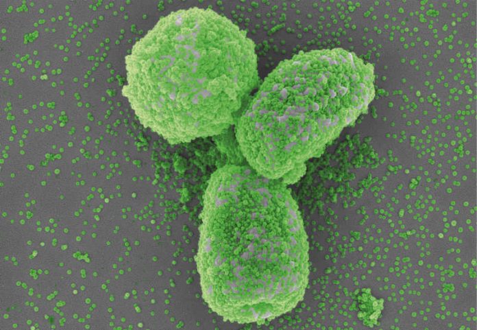 2018-07-05_PM Small meets smaller_Nanopartikeln bedeckte Pilzsporen_small Small meets smaller_Nanopartikeln bedeckte Pilzsporen